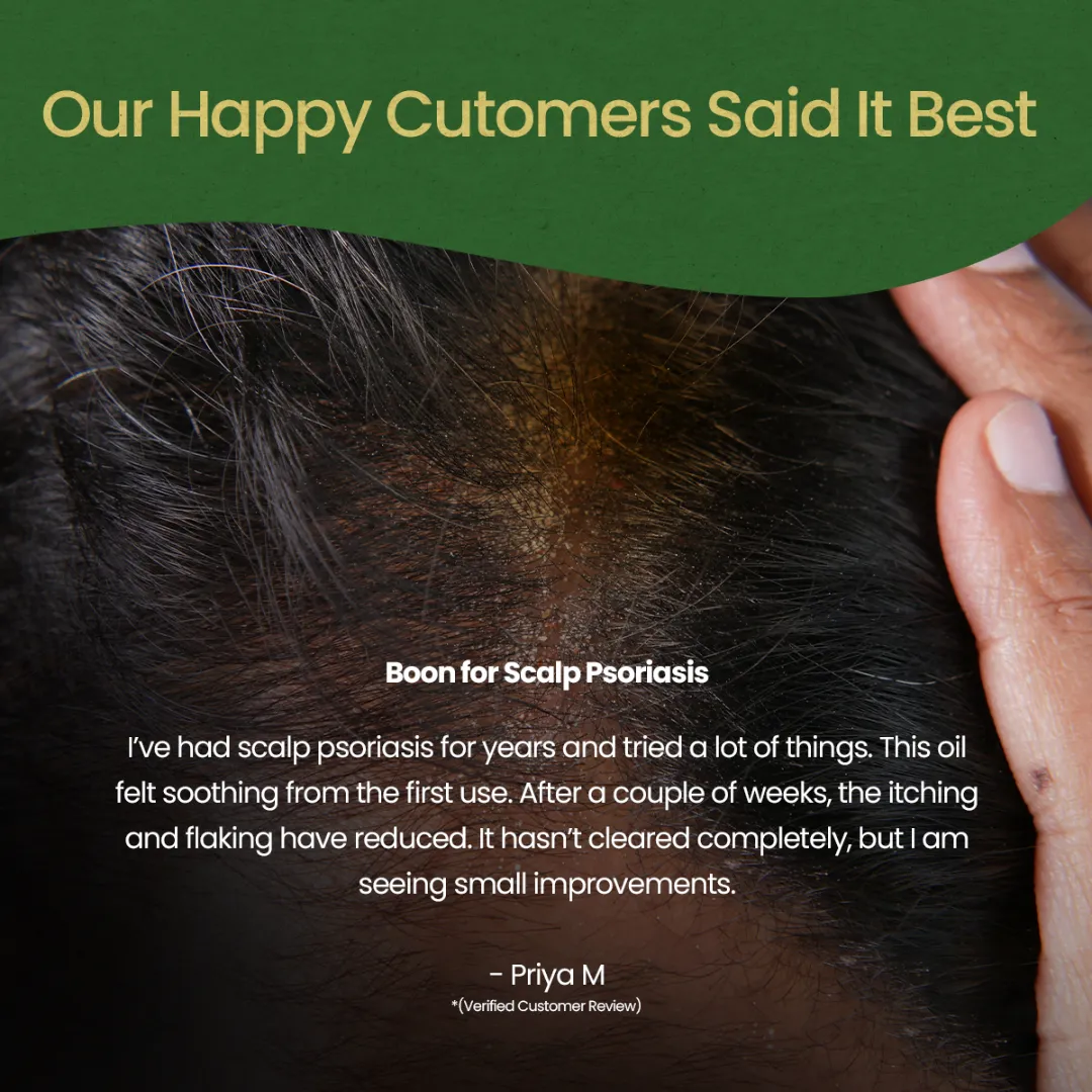Winsoria Oil for Dry, Itchy & Irritated Skin Comfort - Image 7