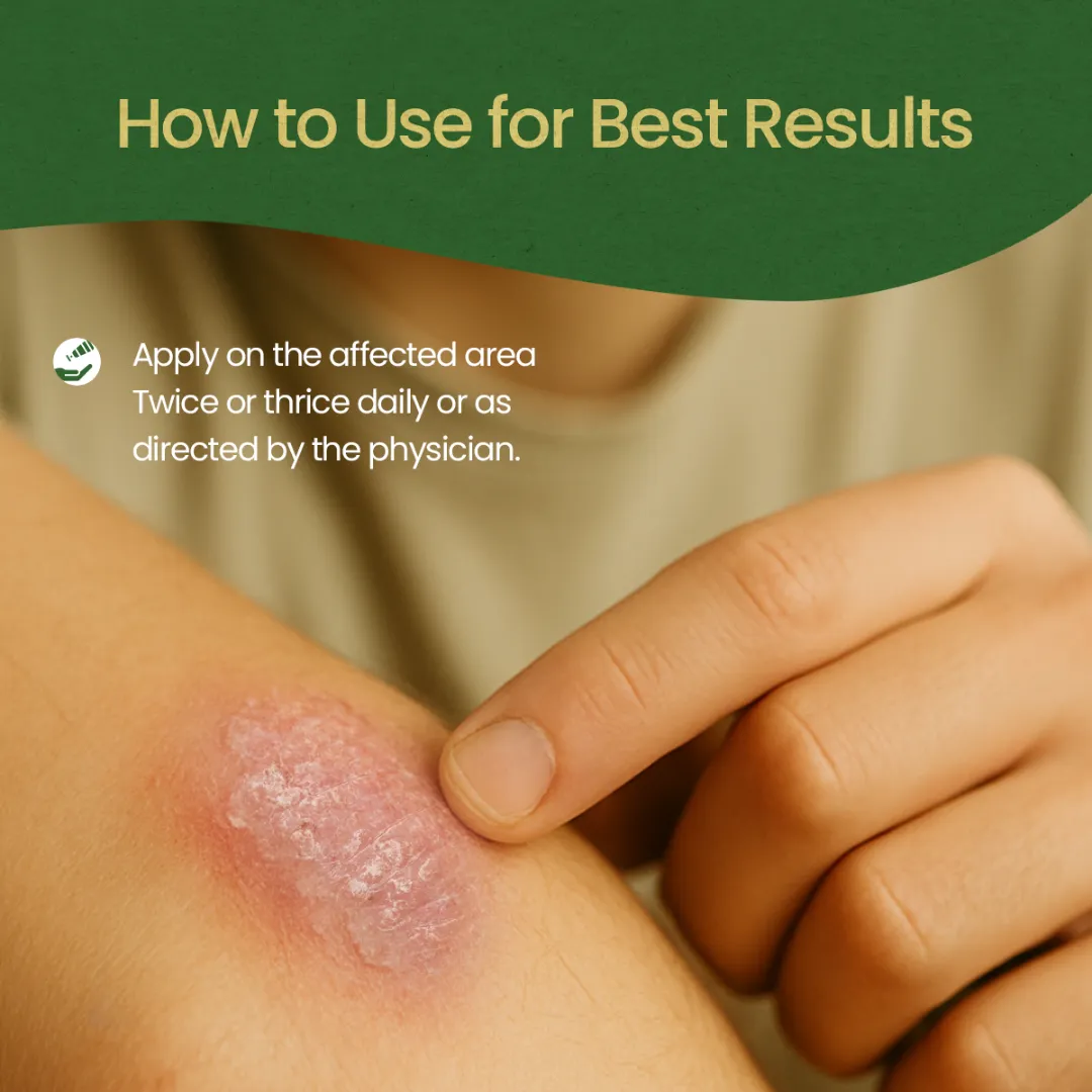 Winsoria Oil for Dry, Itchy & Irritated Skin Comfort - Image 8